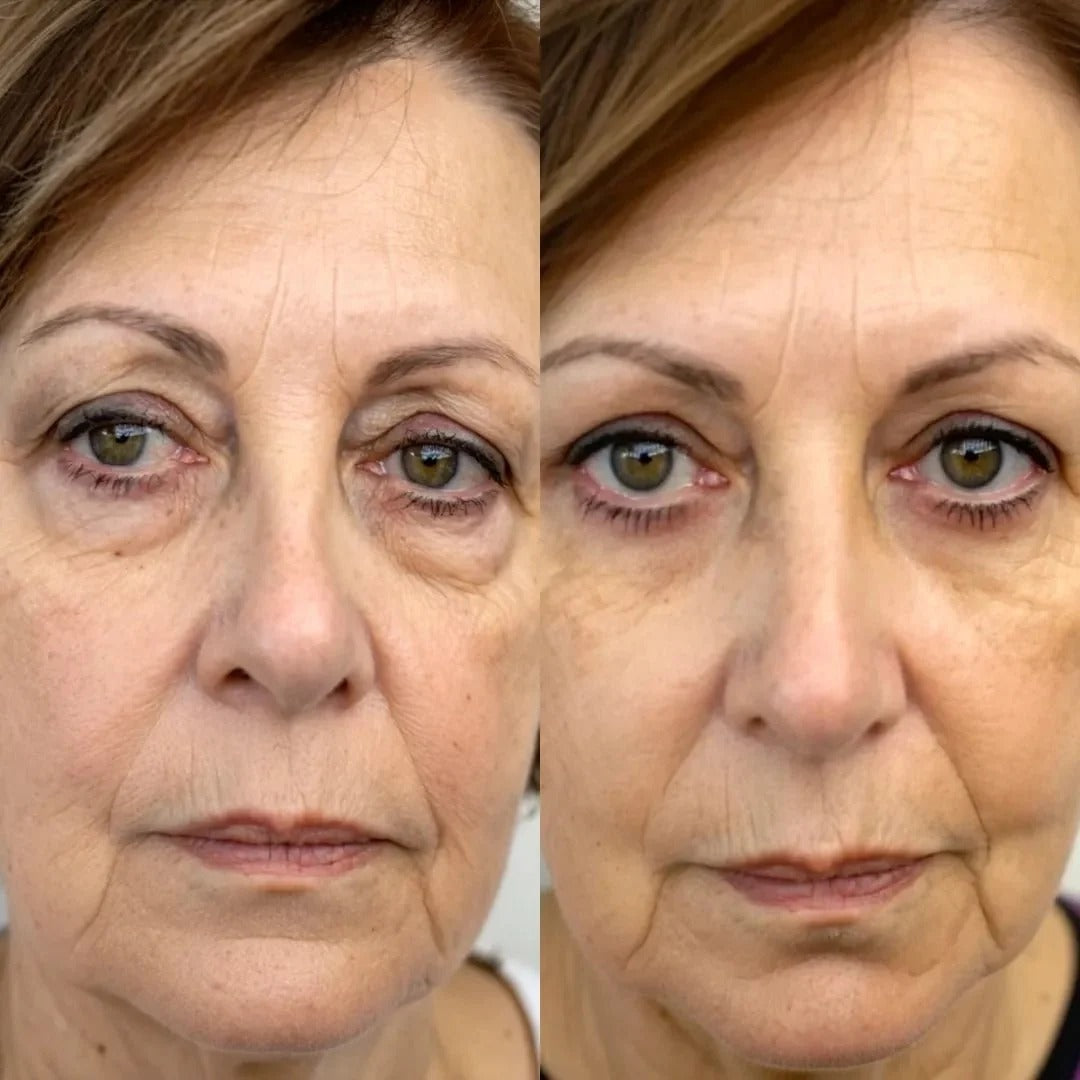 A customer's before and after photos side by side