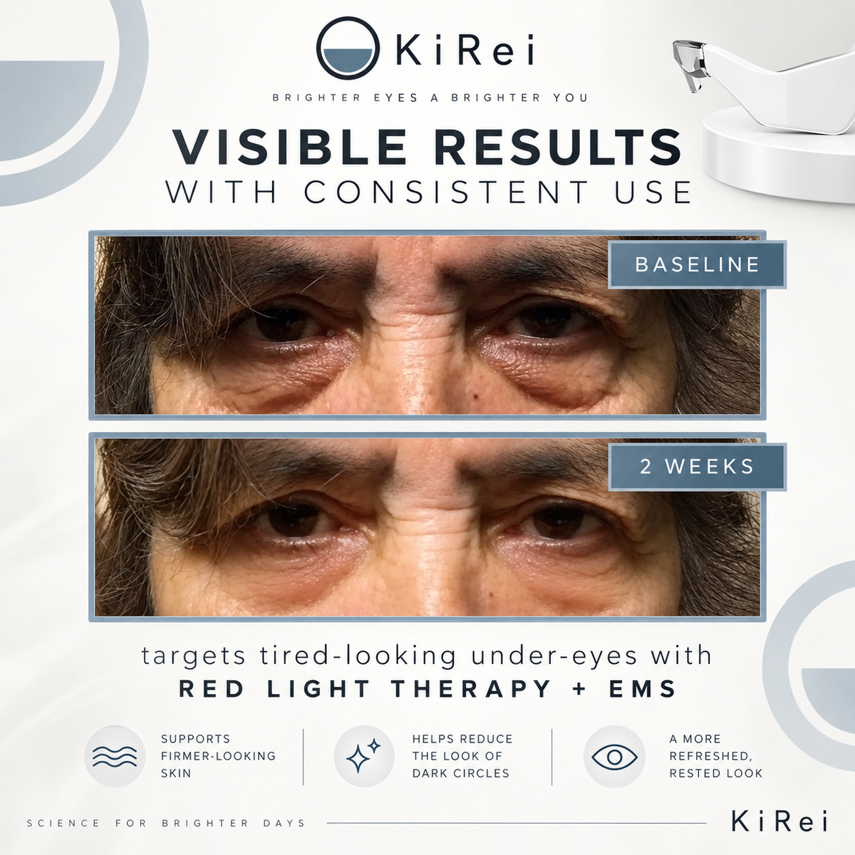 KireiEyes® 2-in-1 Red Light + EMS Under-Eye Device