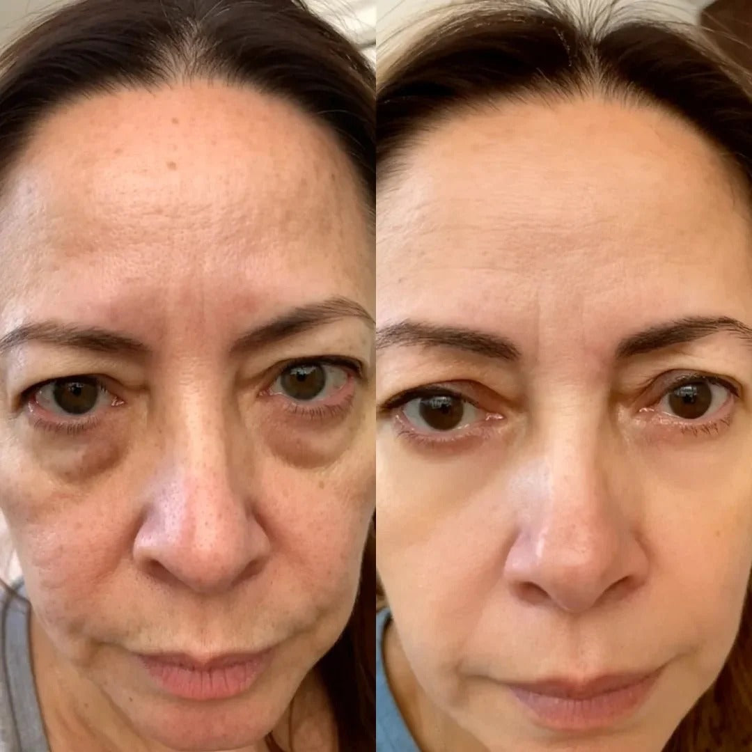 A customer's before and after photos side by side